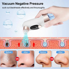 Blackhead Remover Pore Vacuum Cleaner Multifunctional Cleaning Instrument Small Bubble Facial Cleasing Machine Beauty Device
