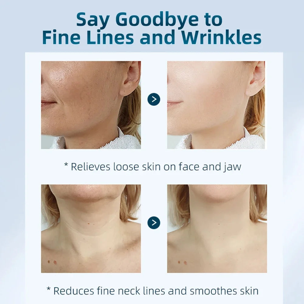 4 Color Neck Beauty Device EMS Face Lifting Machine Double Chin Remover LED Anti Wrinkle Skin Tightening Care Facial Massager