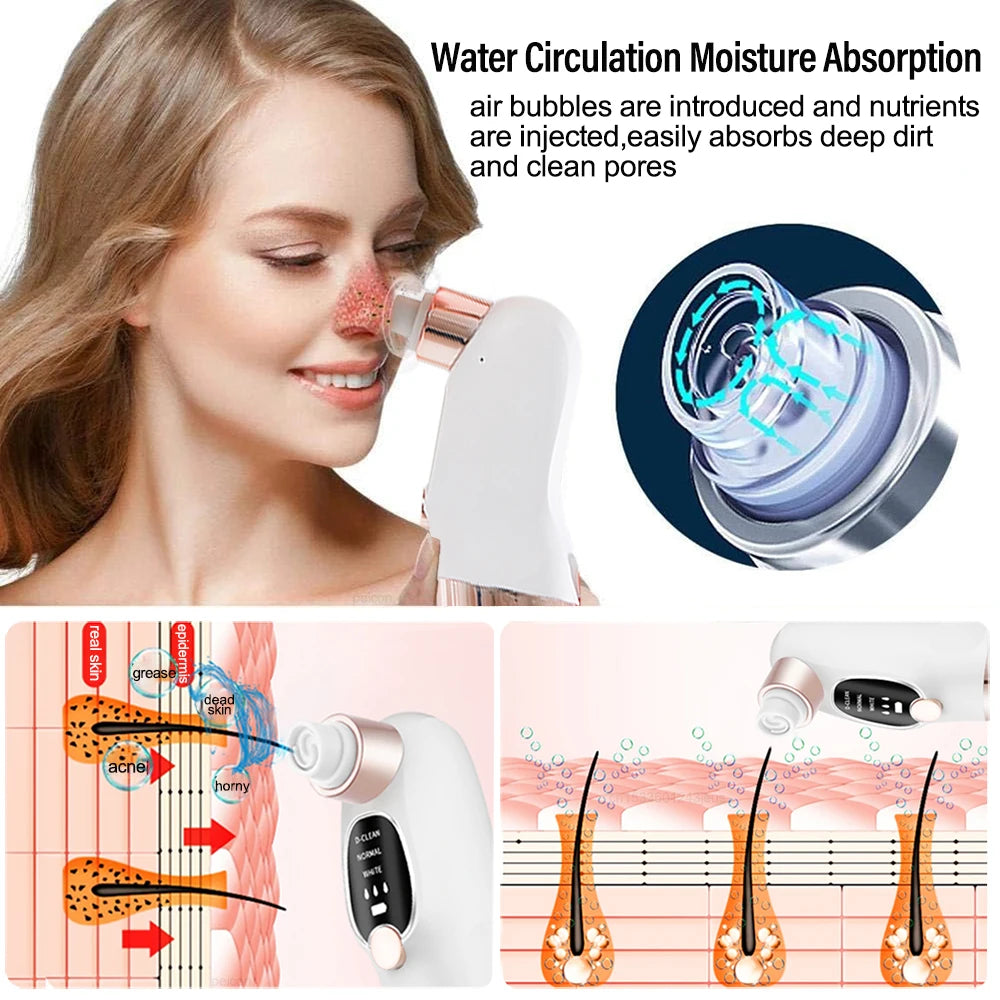 Blackhead Remover Pore Vacuum Cleaner Multifunctional Cleaning Instrument Small Bubble Facial Cleasing Machine Beauty Device